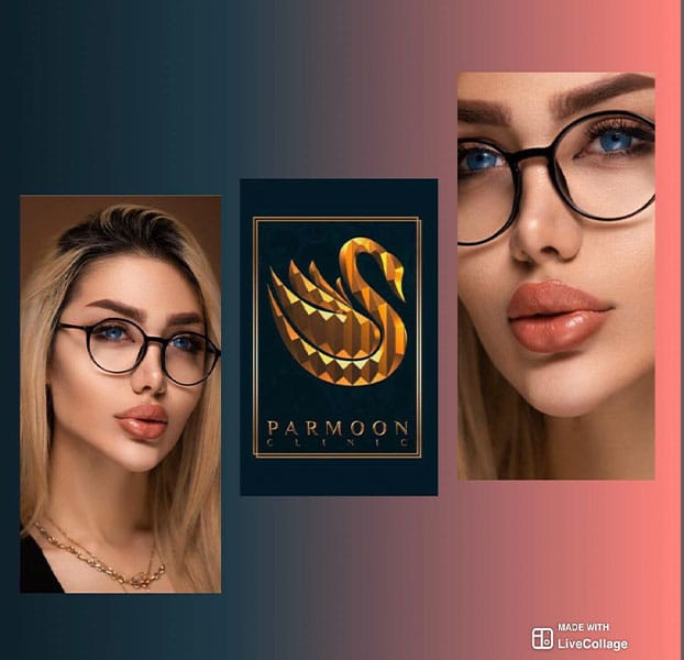 تزریق ژل چانه